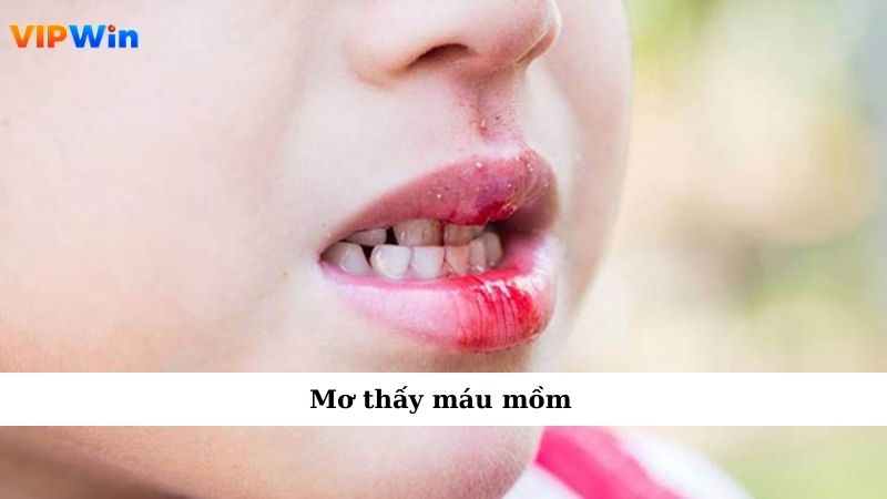 Mơ Thấy Máu Khiến Tim Đập Nhanh Không Hiểu Vì Đâu 2 Mơ thấy máu mồm